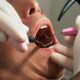cabinet stomatologie sector 1 precum Optim Dental