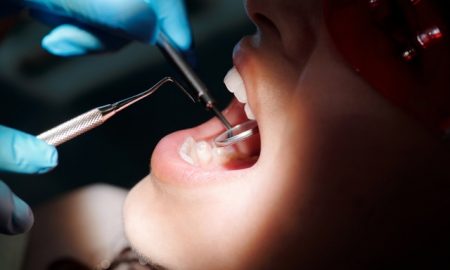 implant dentar Fast & Fixed de la Dental Privilege
