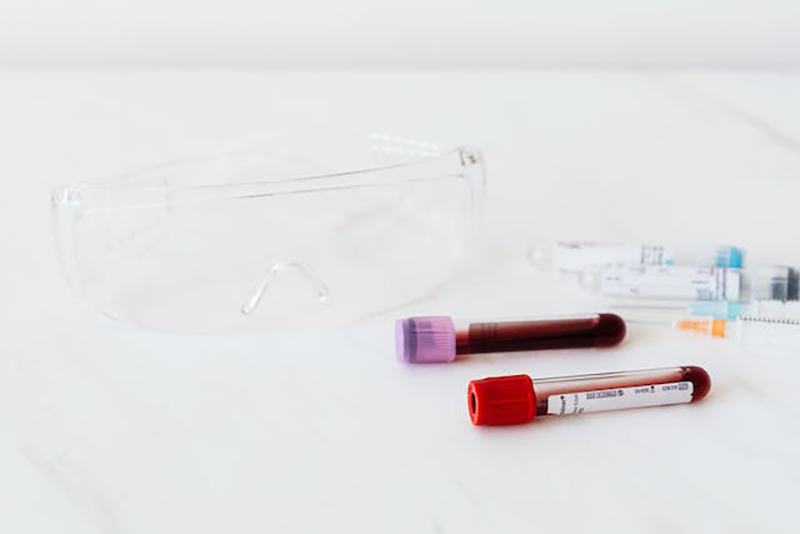 unor analize medicale