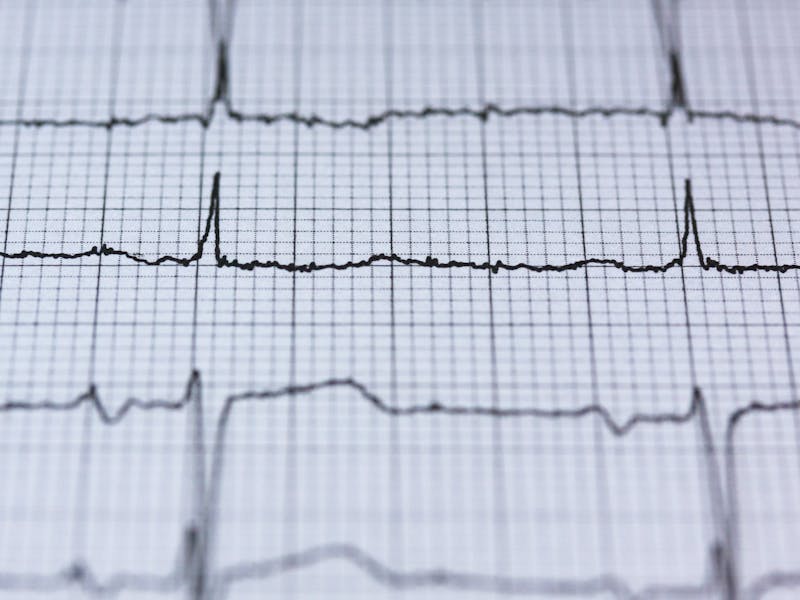 consumabile EKG