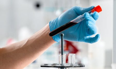 analize hematologie in Iasi de la Clinica Sante